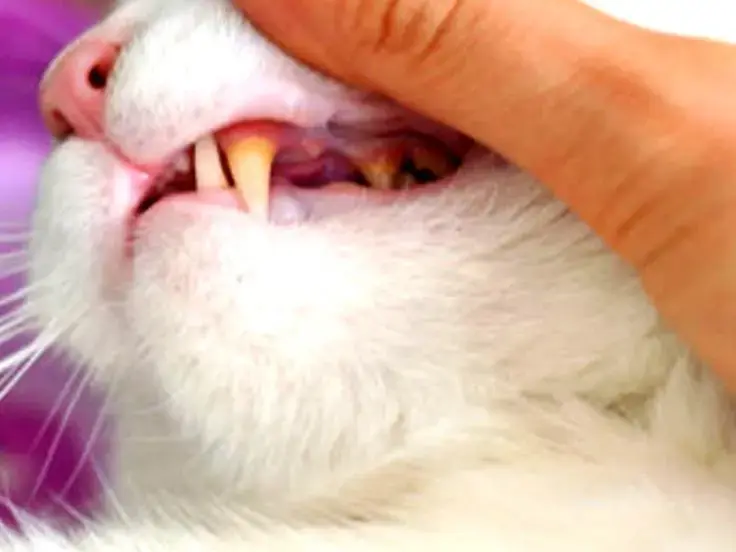 Igiene di bocca e denti
